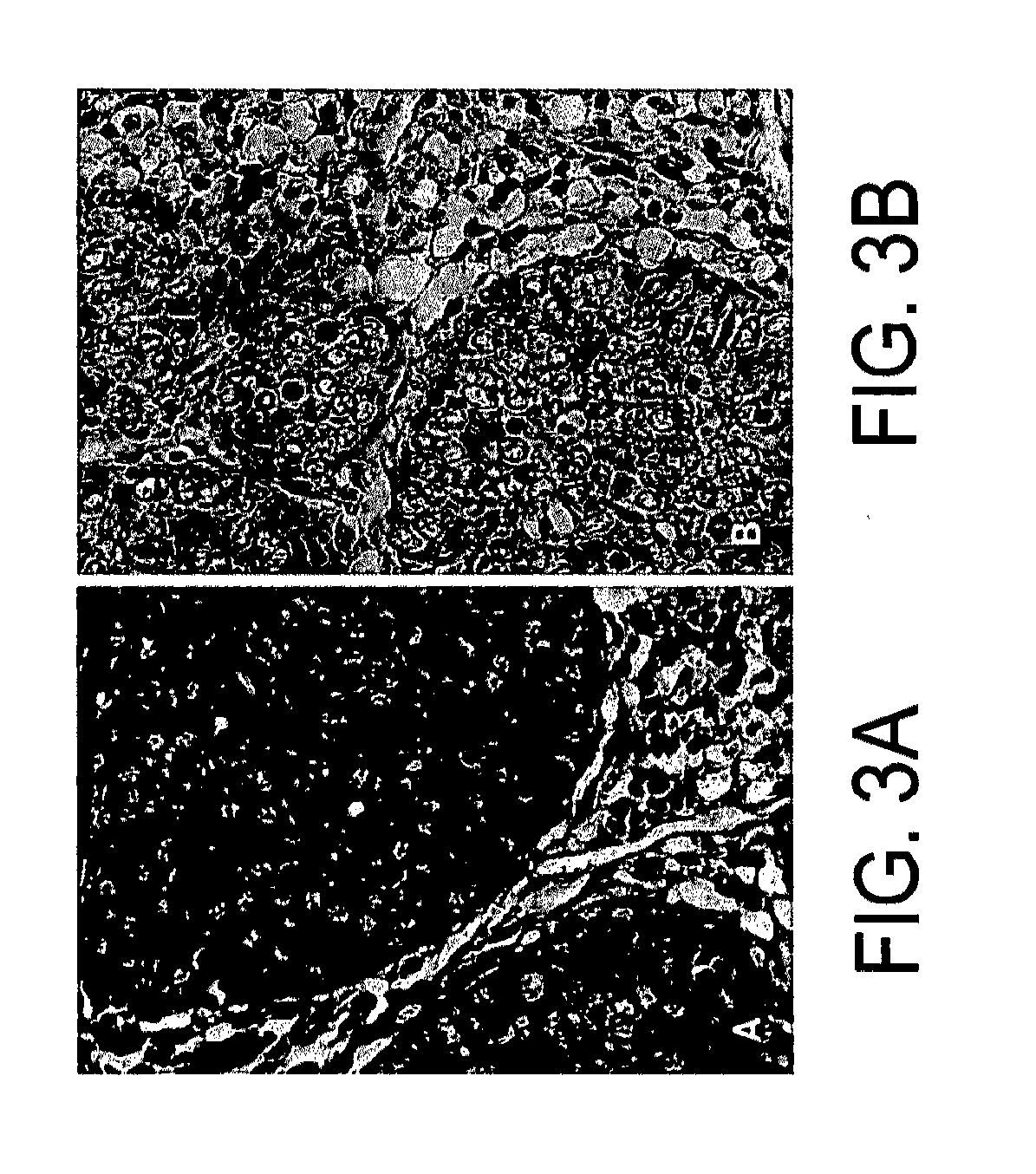 Kits for and methods of differential staining of cervical cancer cells and/or tissues