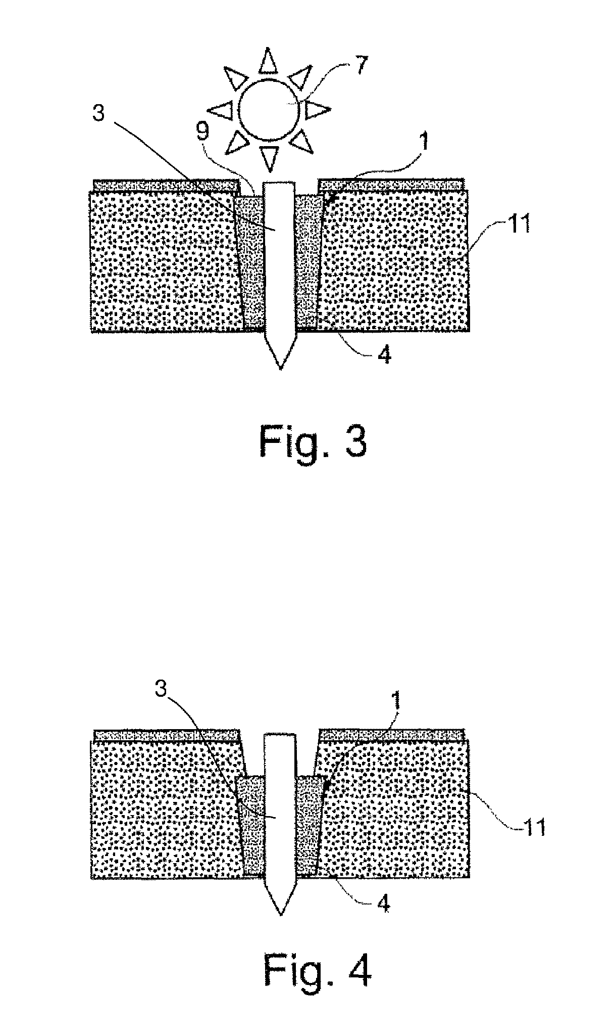 Fixation device with magnesium core