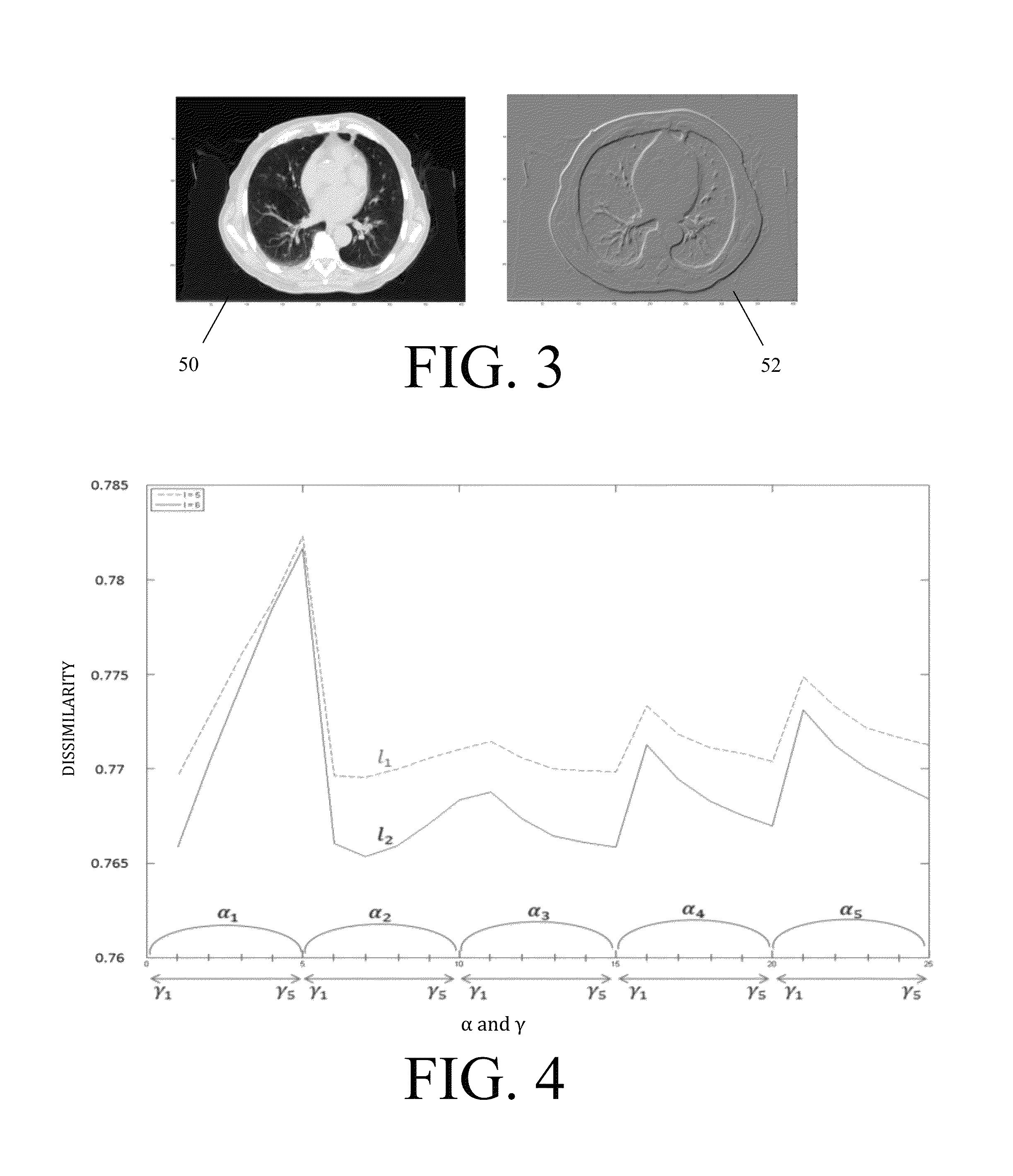 Volumetric deformable registration method for thoracic 4-D computed tomography images and method of determining regional lung function