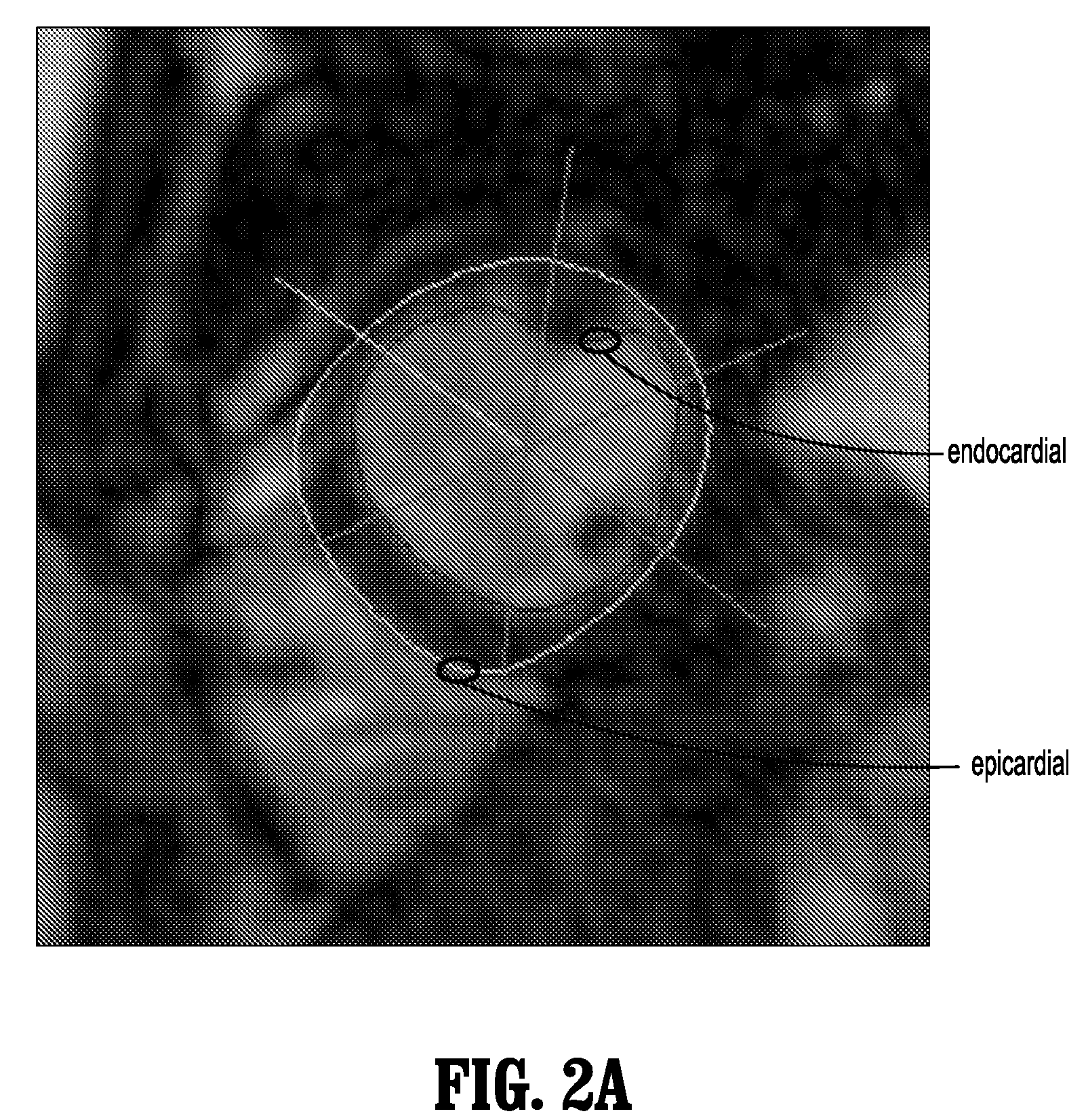 Method and system for monitoring cardiac function of a patient during a magnetic resonance imaging (MRI) procedure