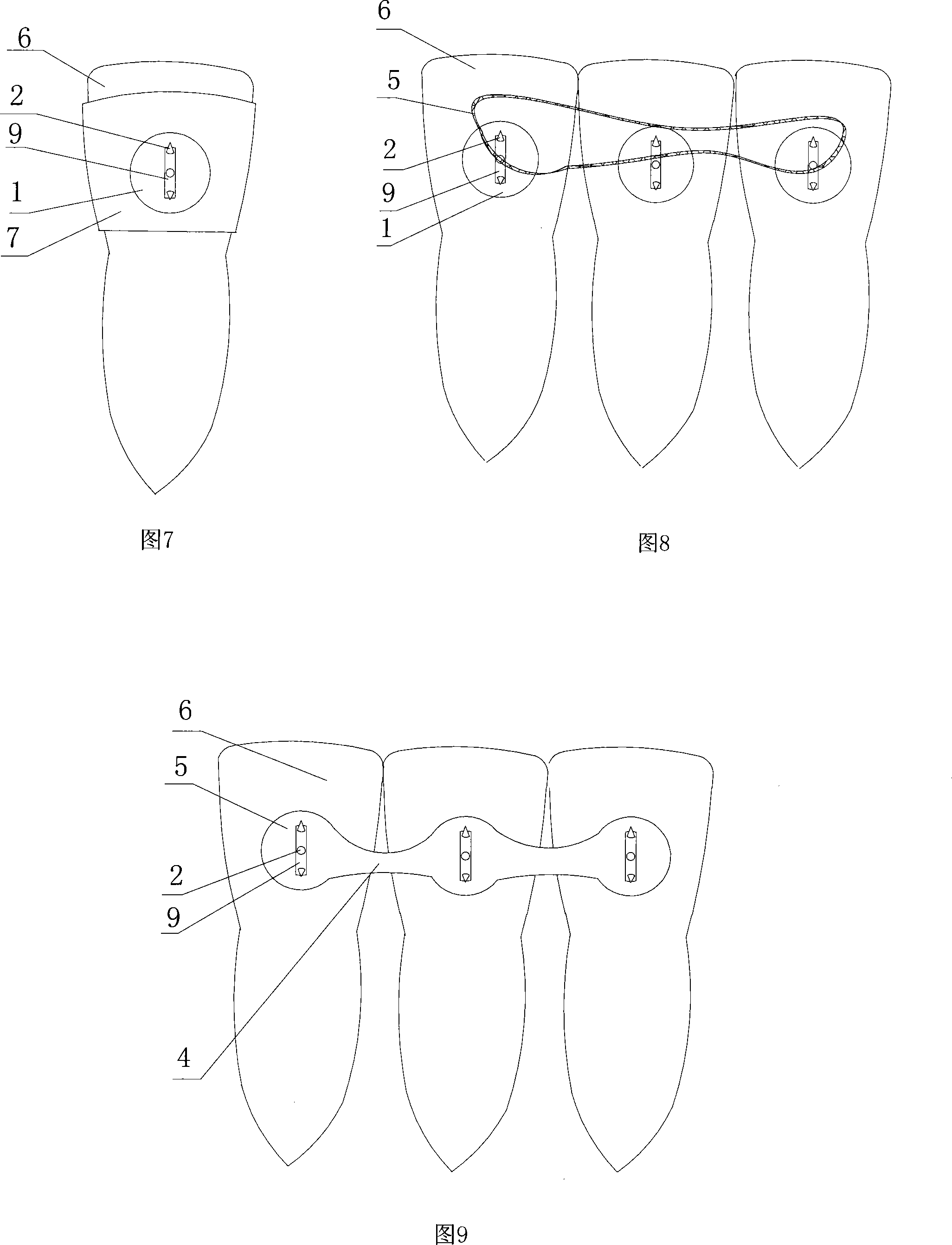 Device for correcting oral cavity function