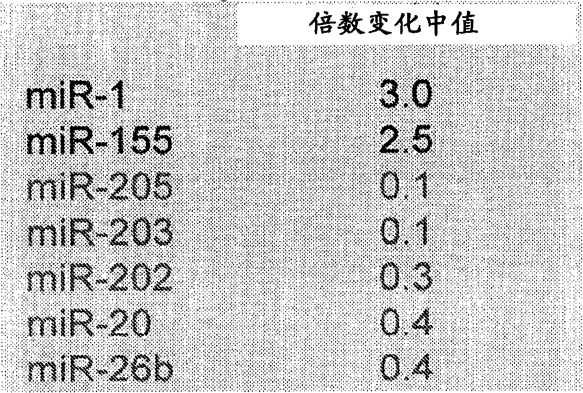 Microrna-based methods and compositions for the diagnosis, prognosis and treatment of gastric cancer