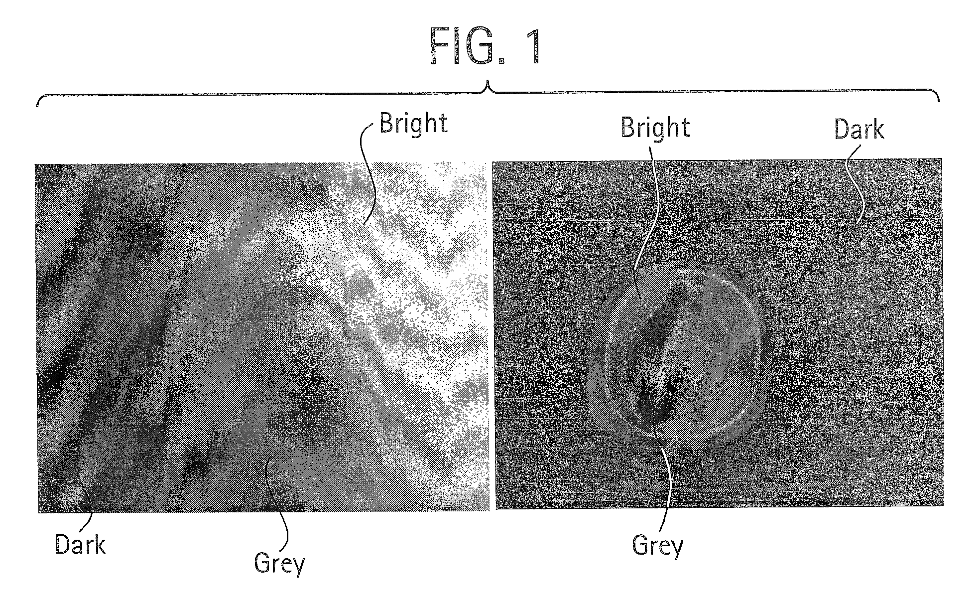 Machine learning based triple region segmentation framework using level set on PACS