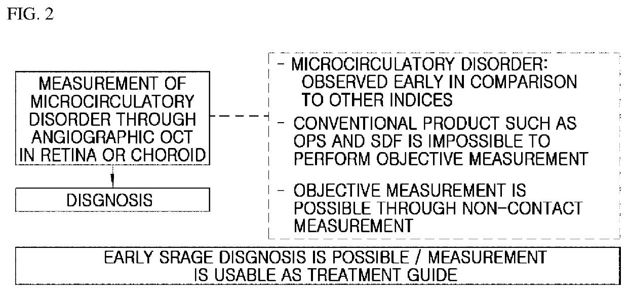 Apparatus for angiographic optical coherence tomography in retina or choroid, and method for diagnosing diseases by using same