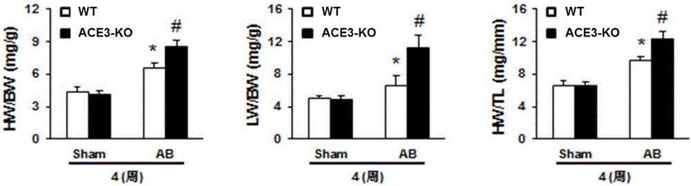 Function and application of angiotensin invertase (ACE3) in treating cardiac hypertrophy