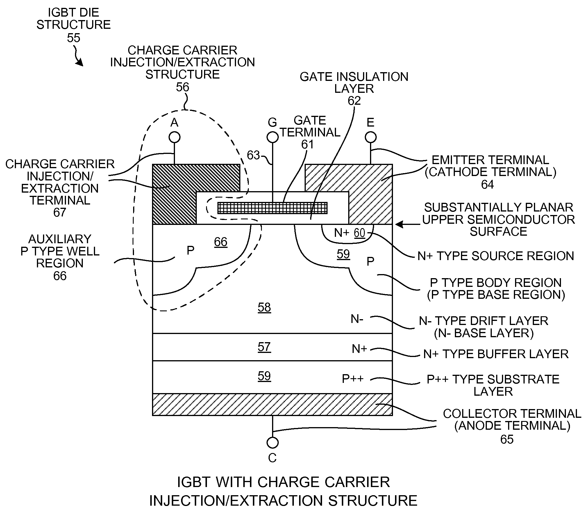 IGBT assembly having circuitry for injecting/extracting current into/from an auxiliary P well