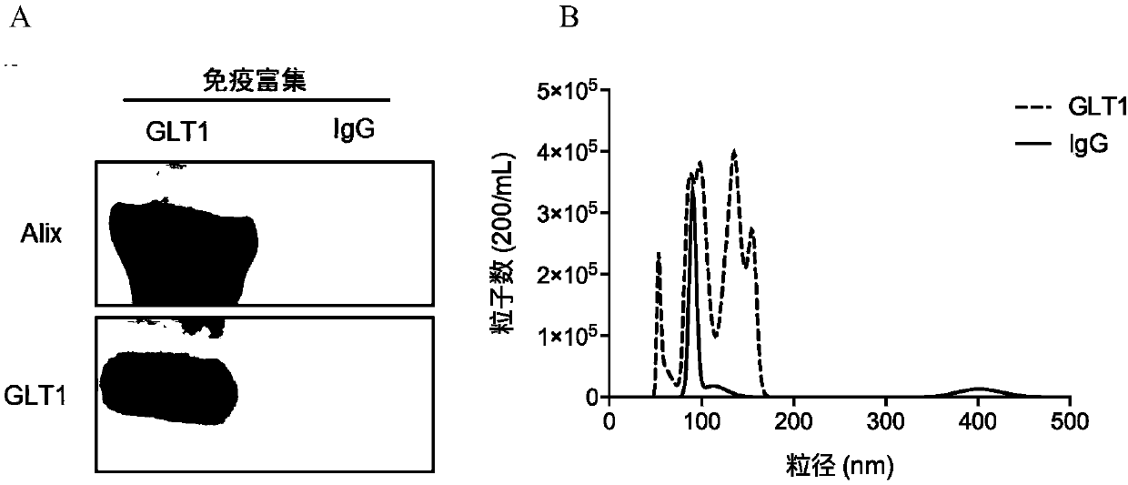 Method for enriching or detecting astrocyte-derived exosomes from biological fluids