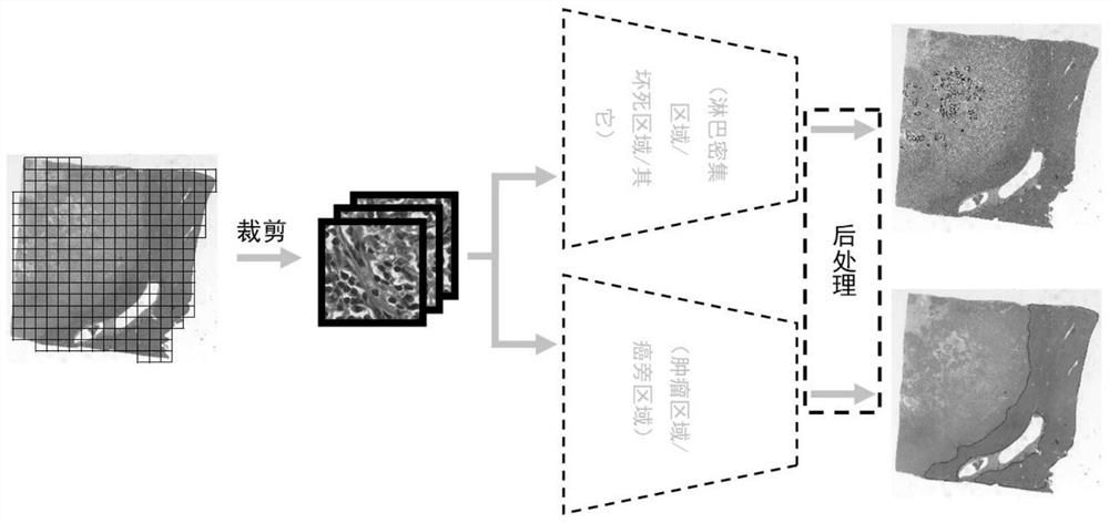 Cancer WSI segmentation method based on local classification neural network