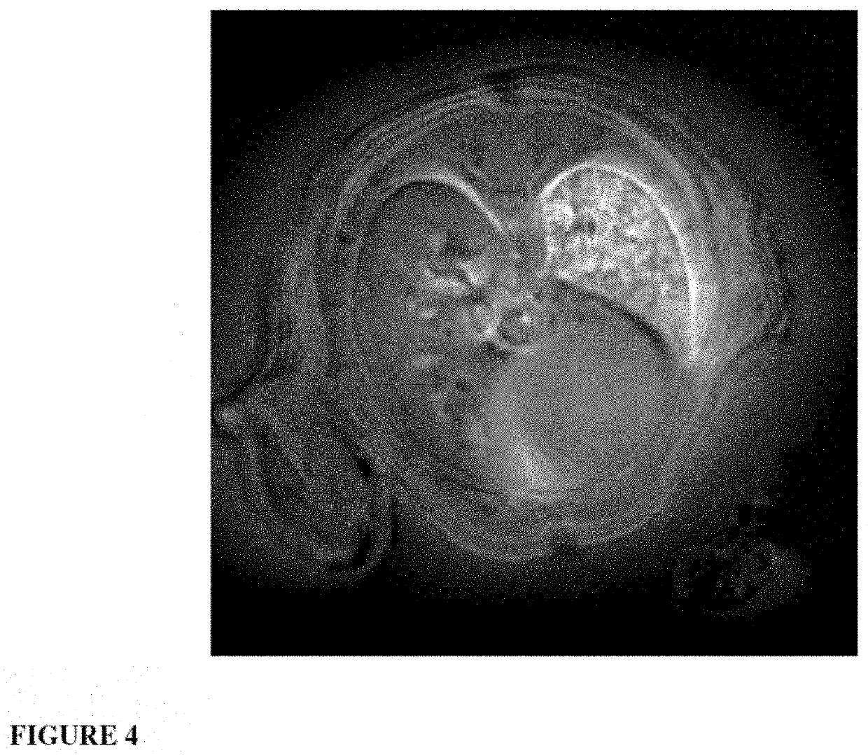 Ultrafine nanoparticles as multimodal contrast agent