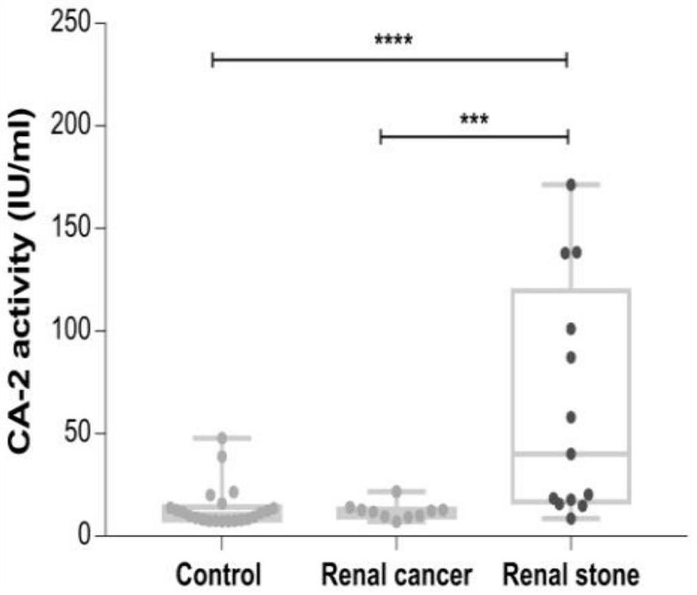 Application of carbonic anhydrase-2 as a detection marker in the diagnosis of kidney stones