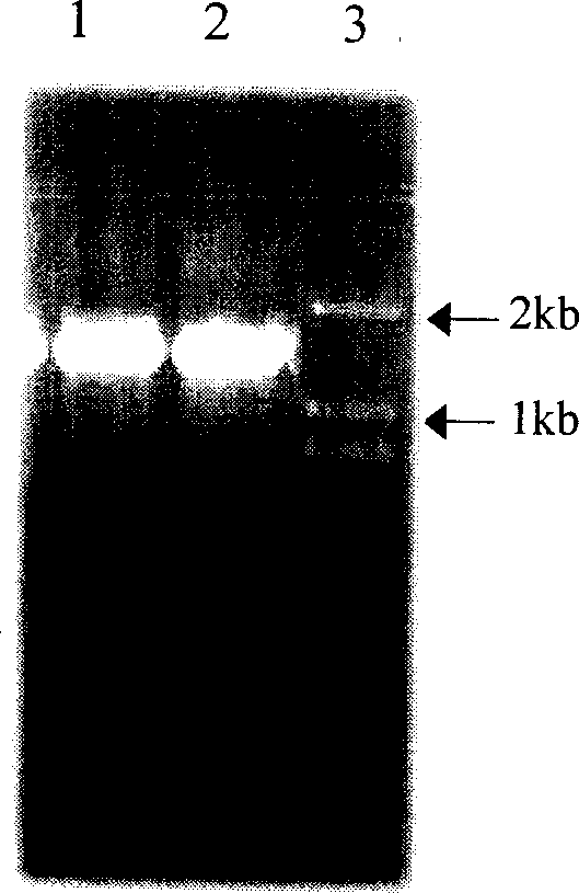 Medlar carotenoid synthase gene lycB and plasmid comprising the gene
