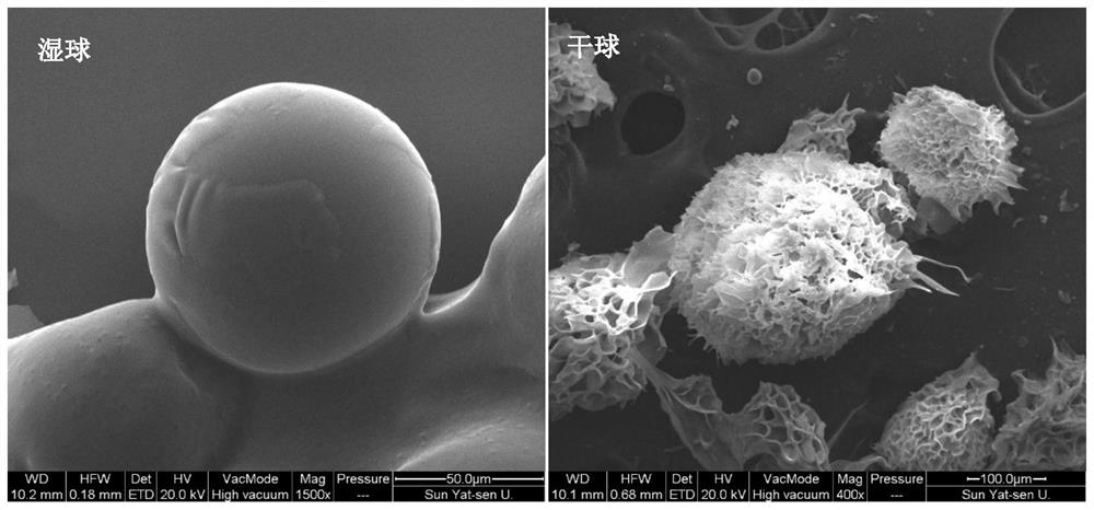 Embolism microsphere based on soluble starch as well as preparation and application of embolism microsphere