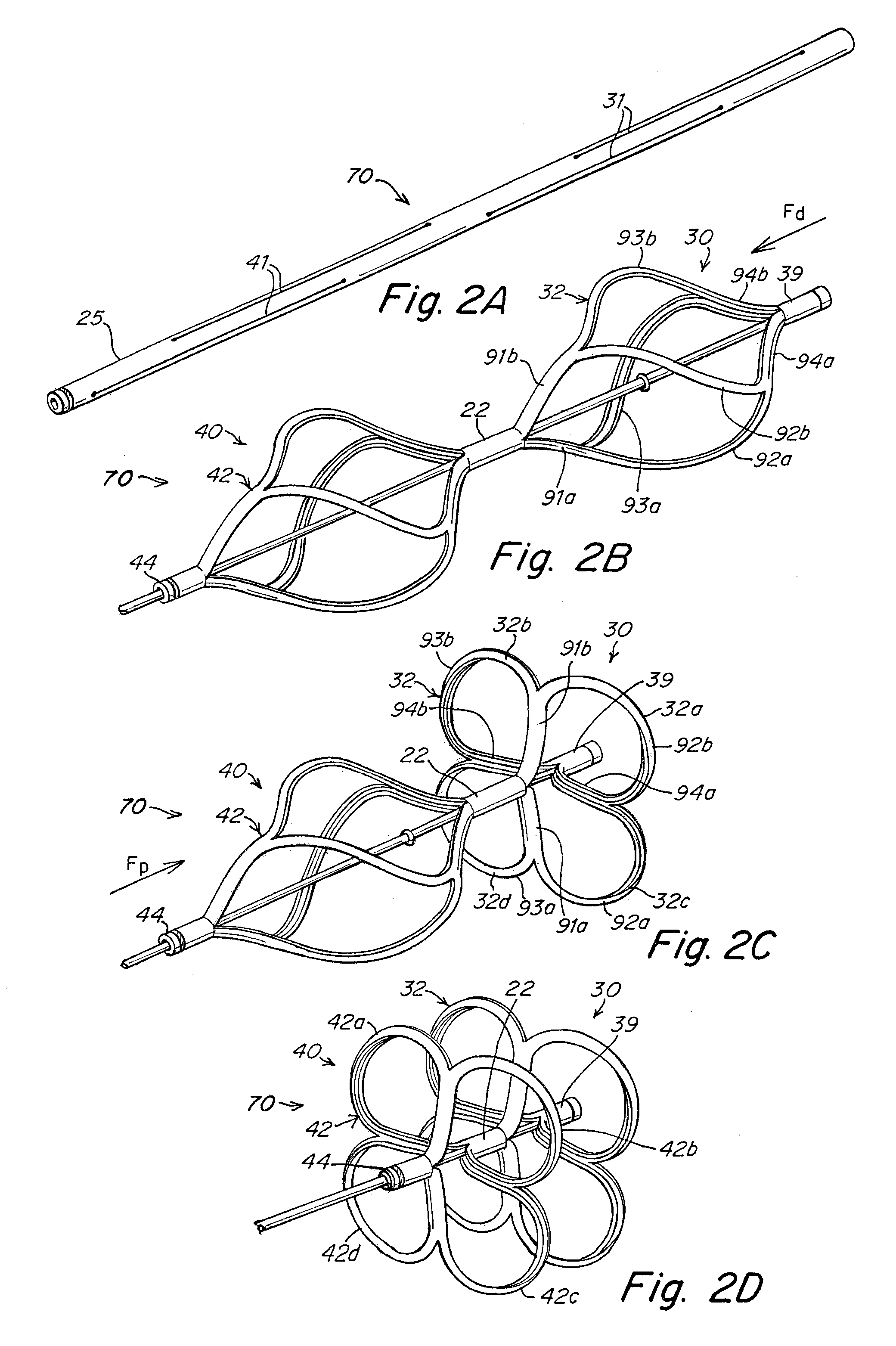 Implant-catheter attachment mechanism using snare and method of use