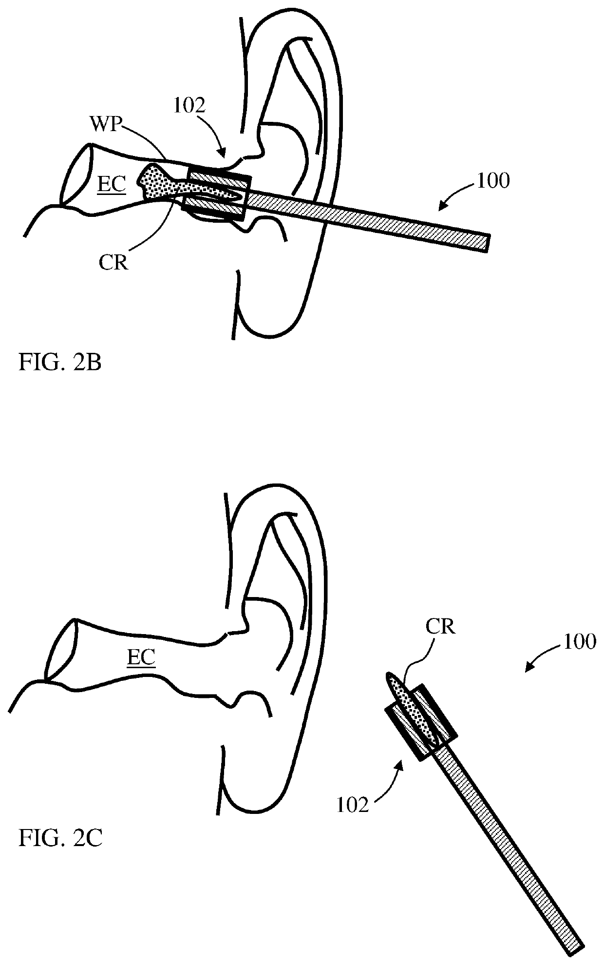 Apparatus and method for treating or/and refreshing an ear canal