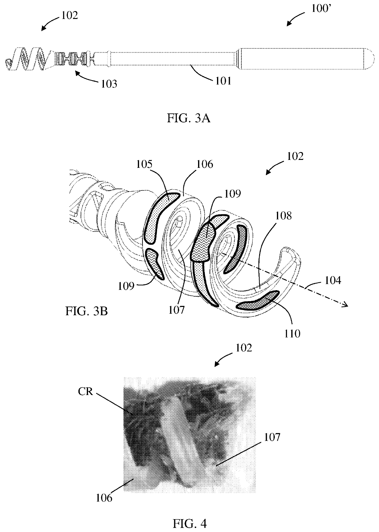 Apparatus and method for treating or/and refreshing an ear canal