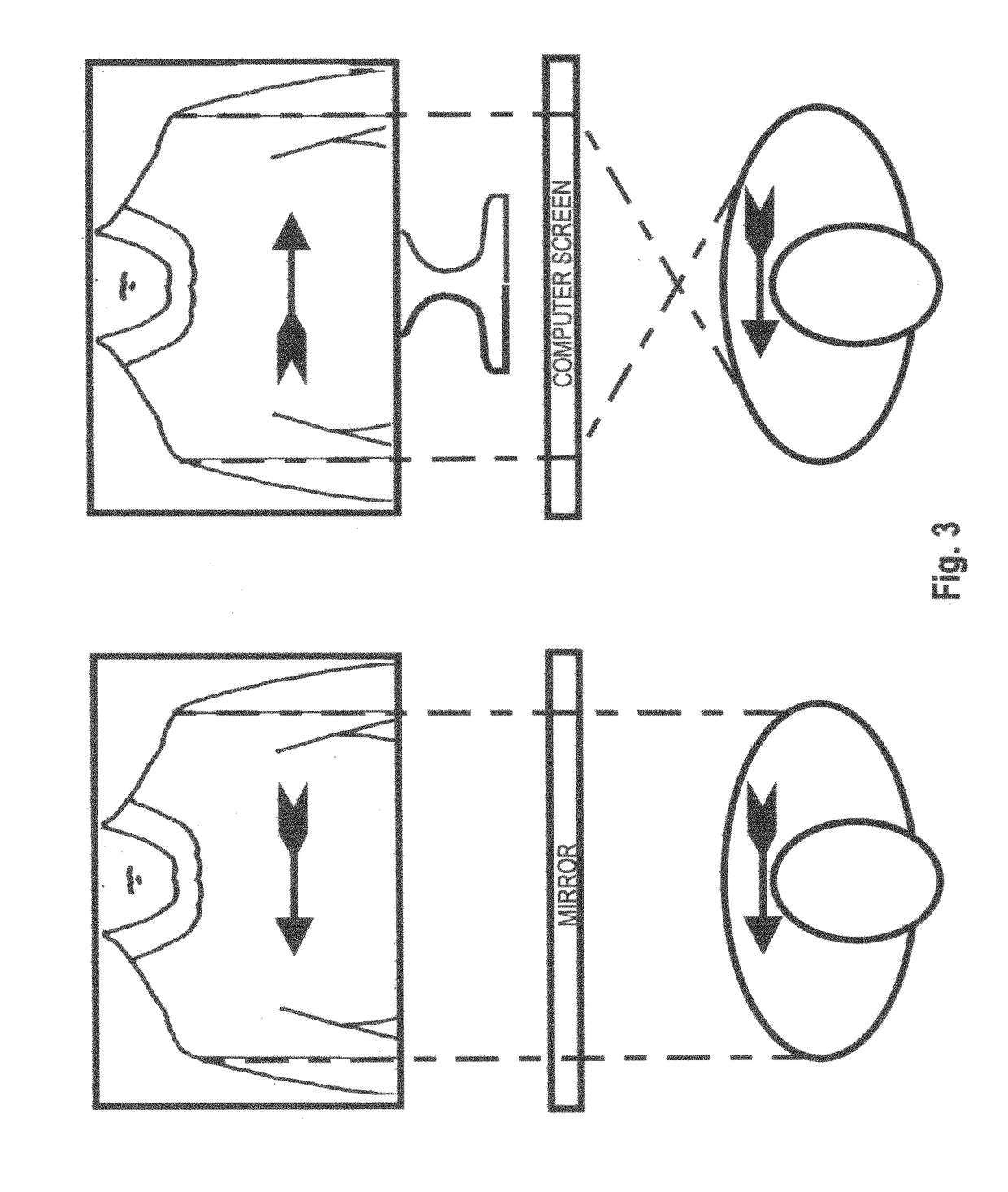 Solo home user skin imaging method, alignment aid, and chromatic filter for detecting growth of early melanomas