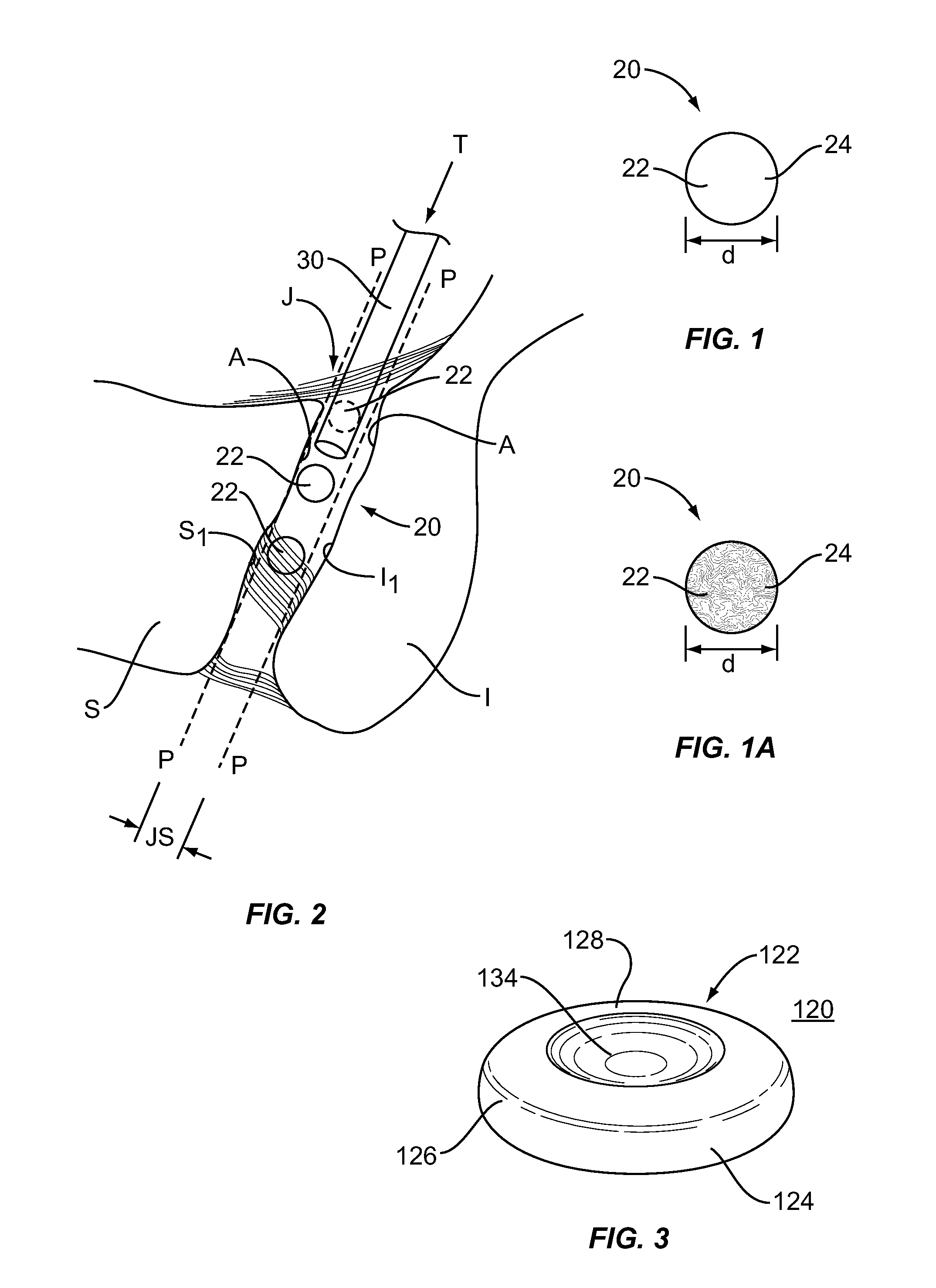 Sacro-iliac joint implant system and method