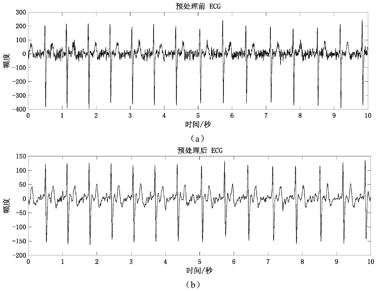 Three-factor method cuffless continuous blood pressure detection system based on artificial neural network
