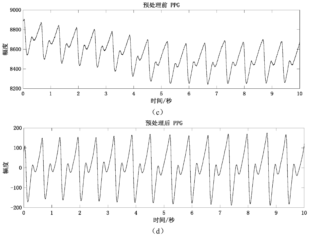 Three-factor method cuffless continuous blood pressure detection system based on artificial neural network
