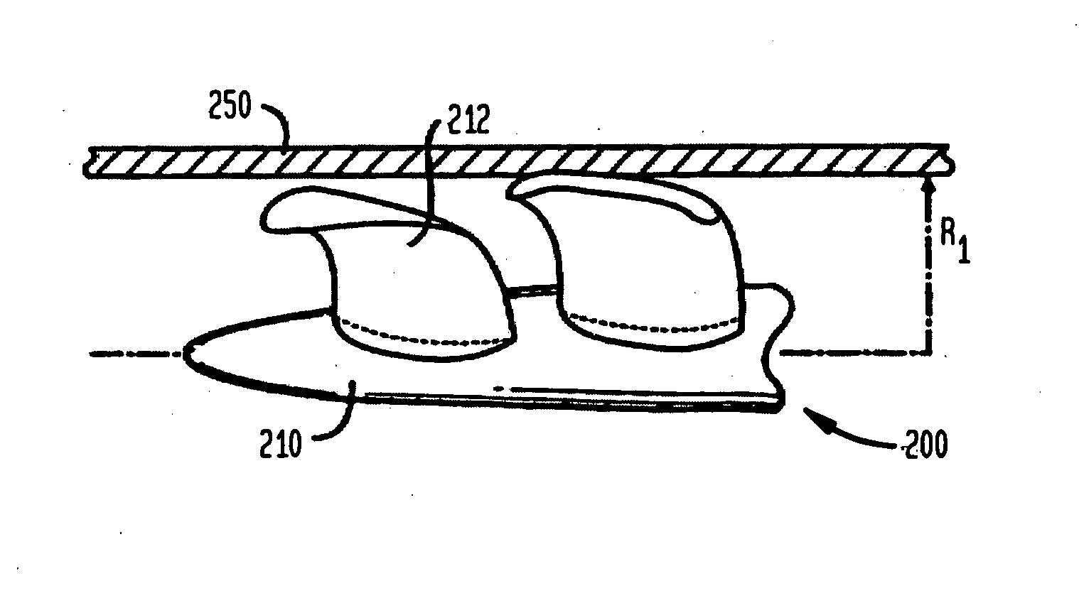 Heart assist device with expandable impeller pump