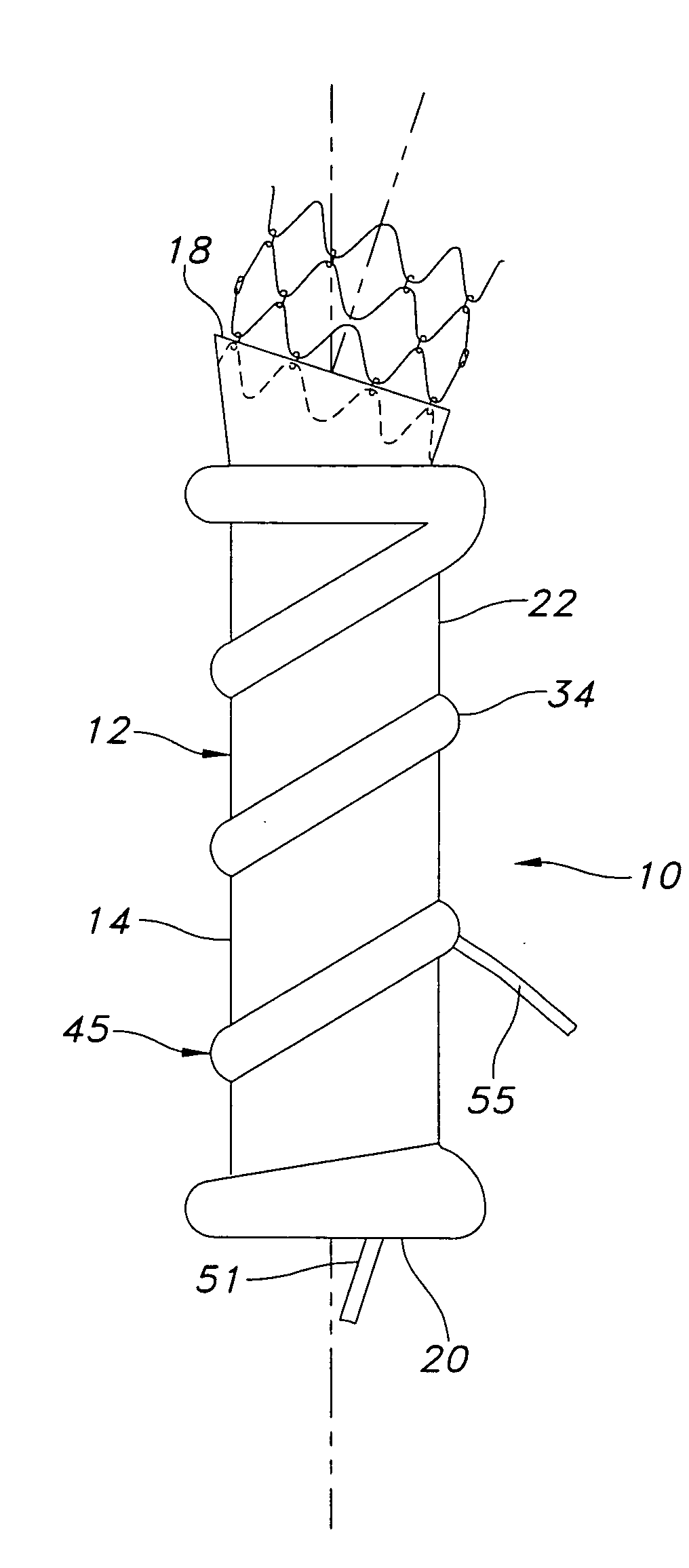 Dual chamber cuff structure