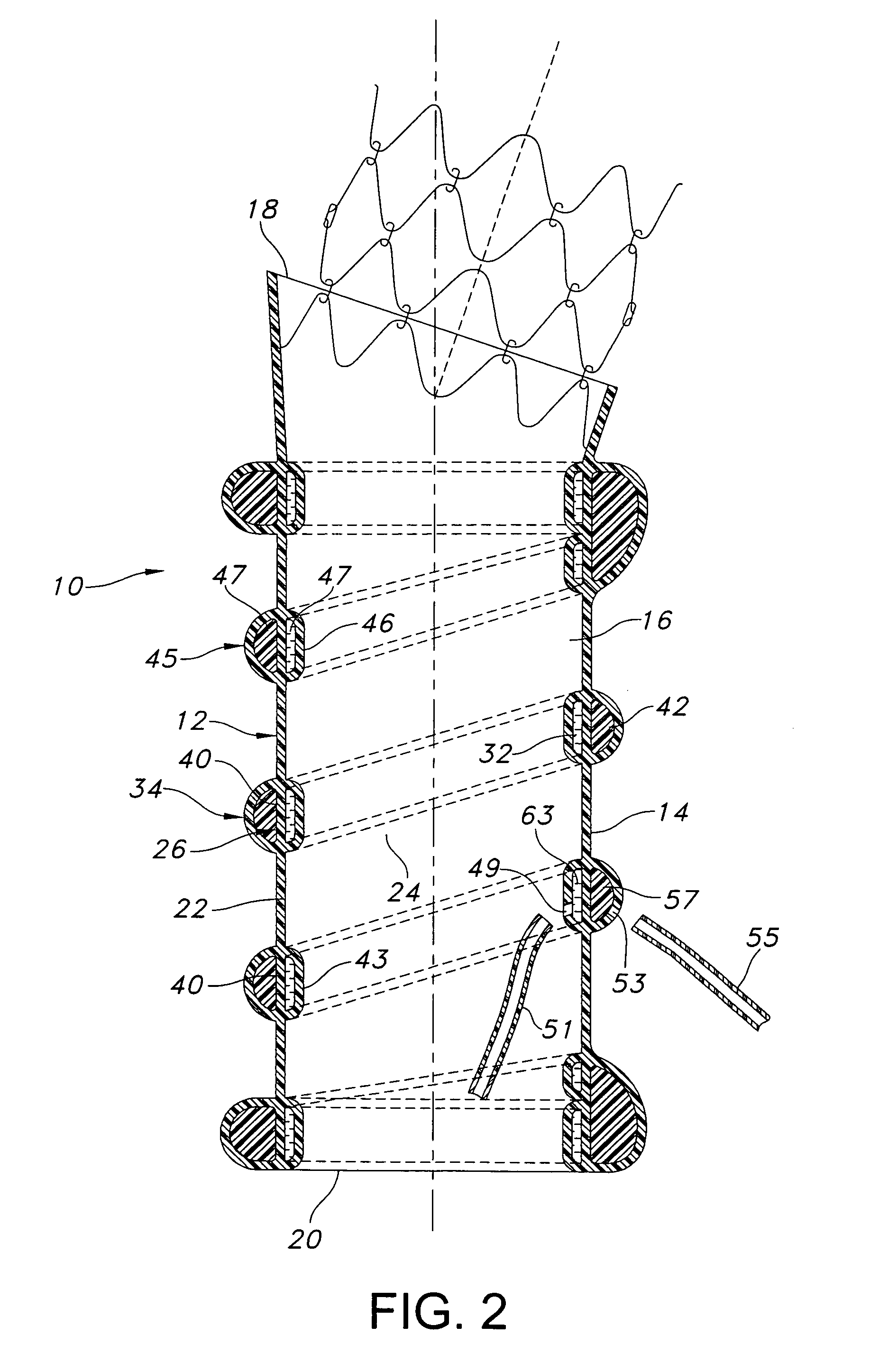 Dual chamber cuff structure