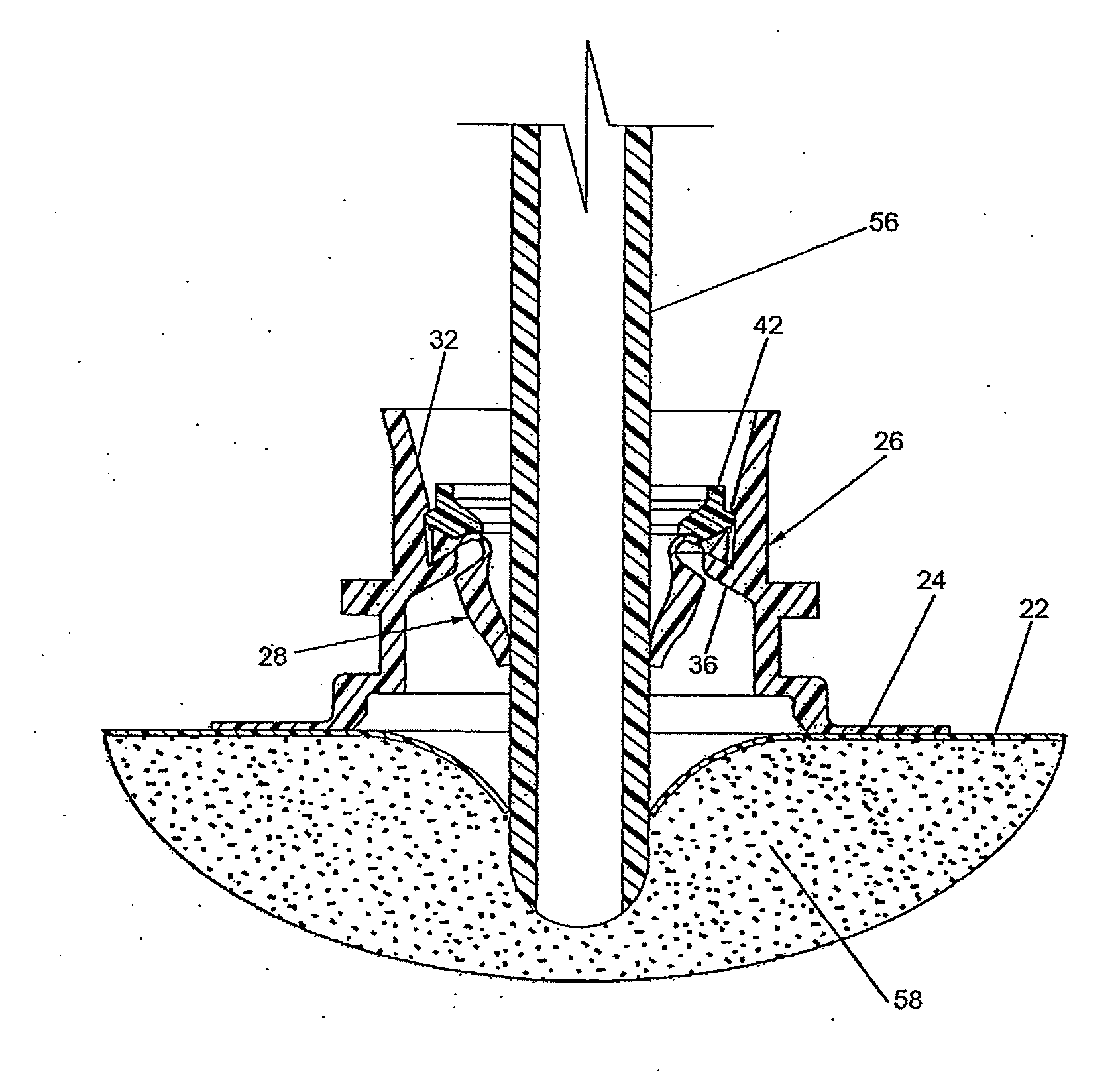 Dispensing closure system, flexible package with a dispensing closure system, method of filling the same by a form-fill-seal machine and method of dispensing a flowable product from said package