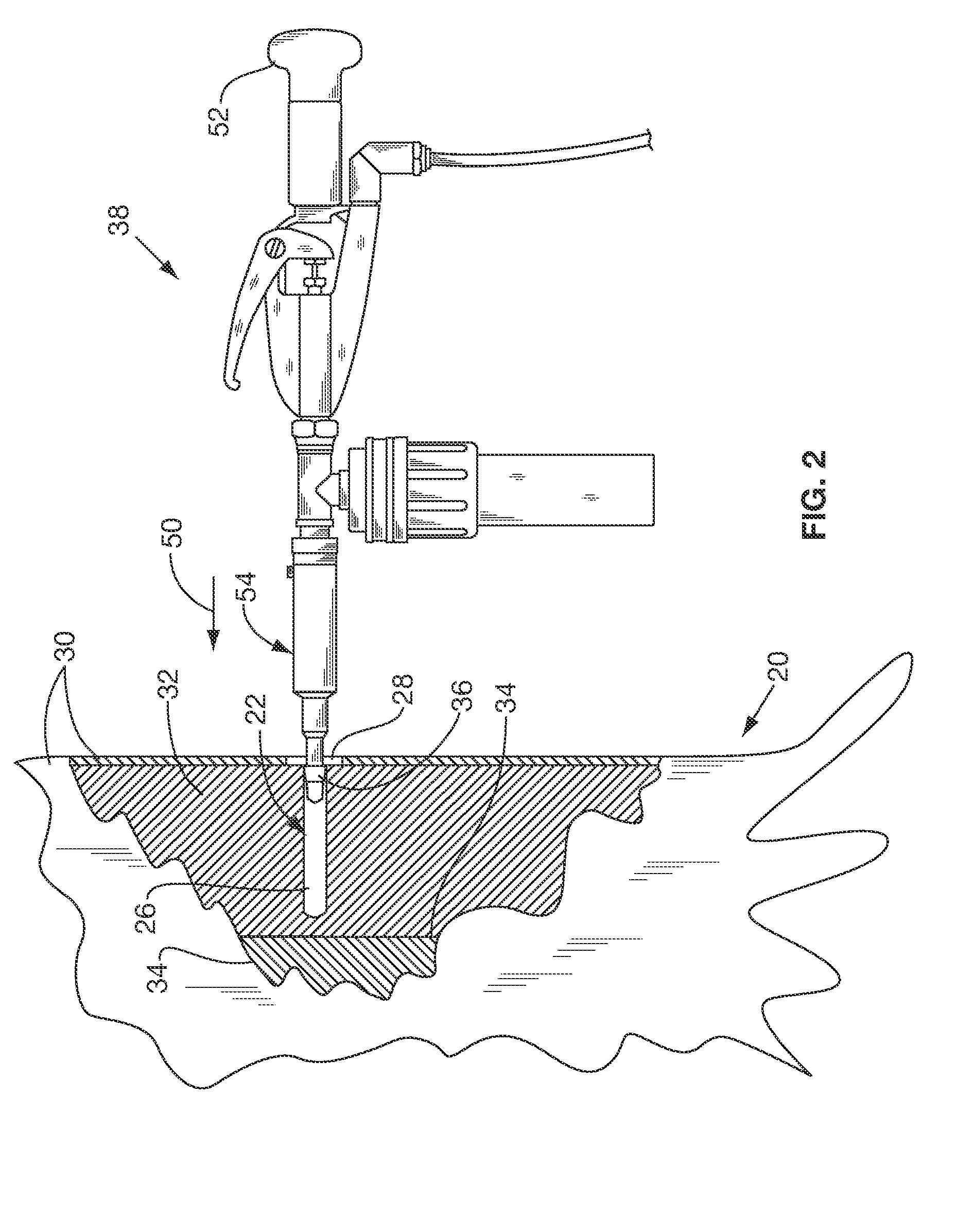 Tree injection apparatus and methods