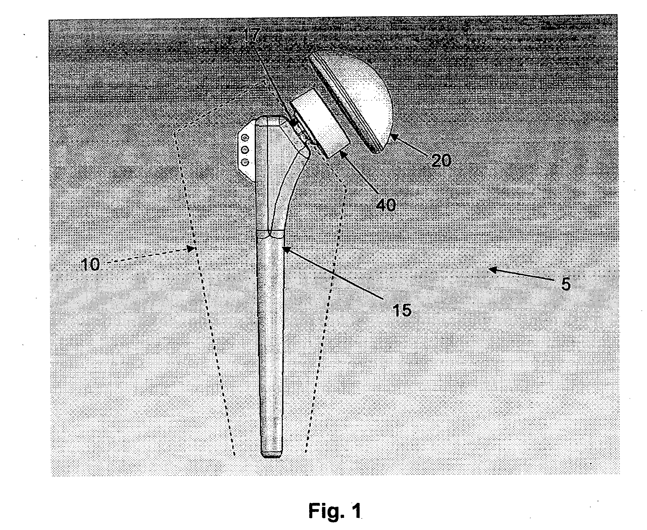 Method and apparatus for reconstructing a joint