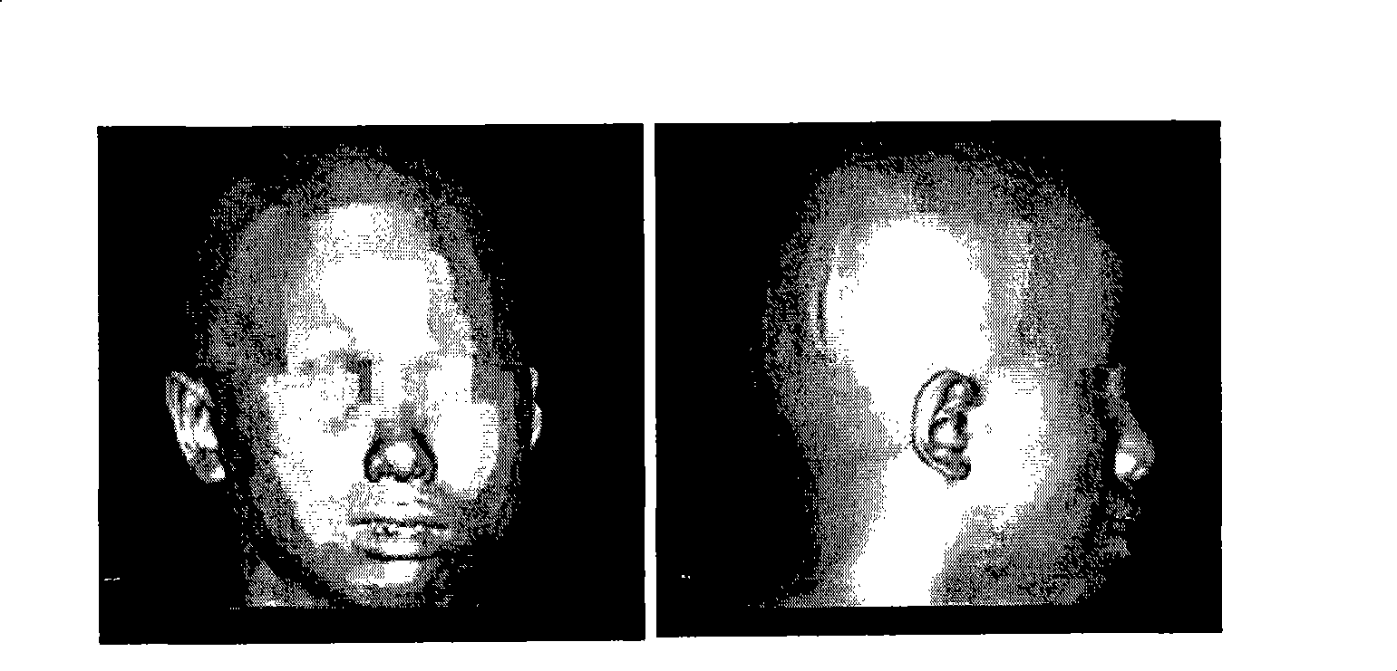 Special shape tissue engineering bracket and construction method and use thereof