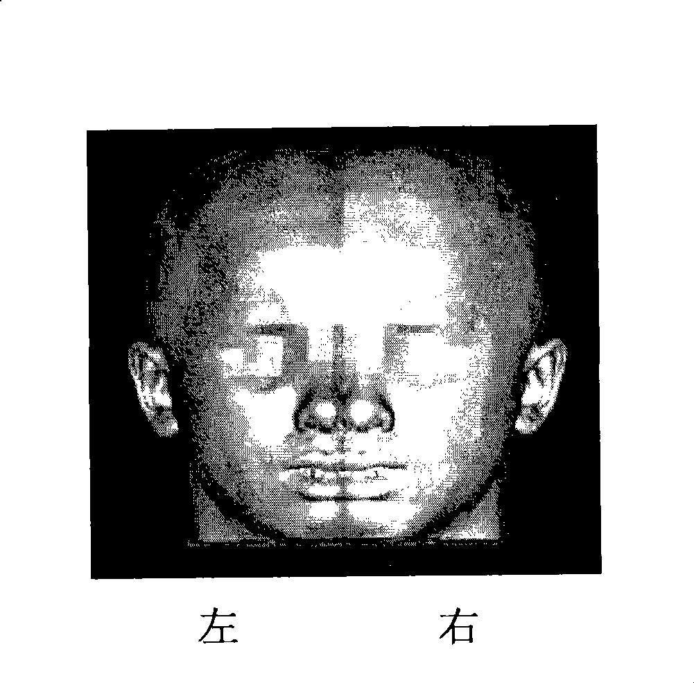 Special shape tissue engineering bracket and construction method and use thereof