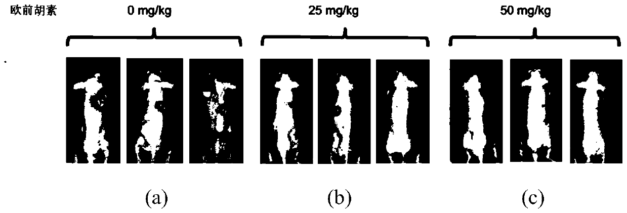 Application of imperatorin in the preparation of drugs for inhibiting esophageal cancer