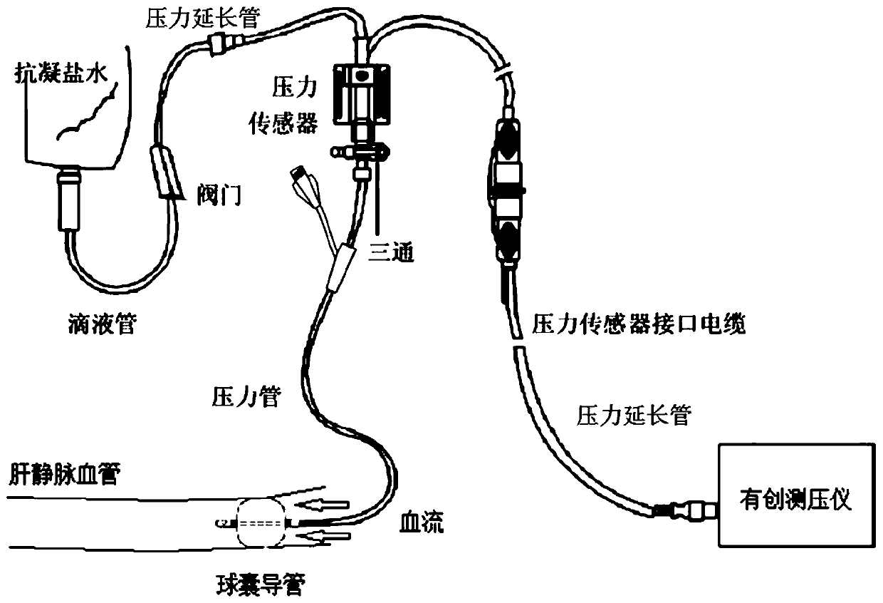 HVPG balloon catheter and manufacturing method thereof