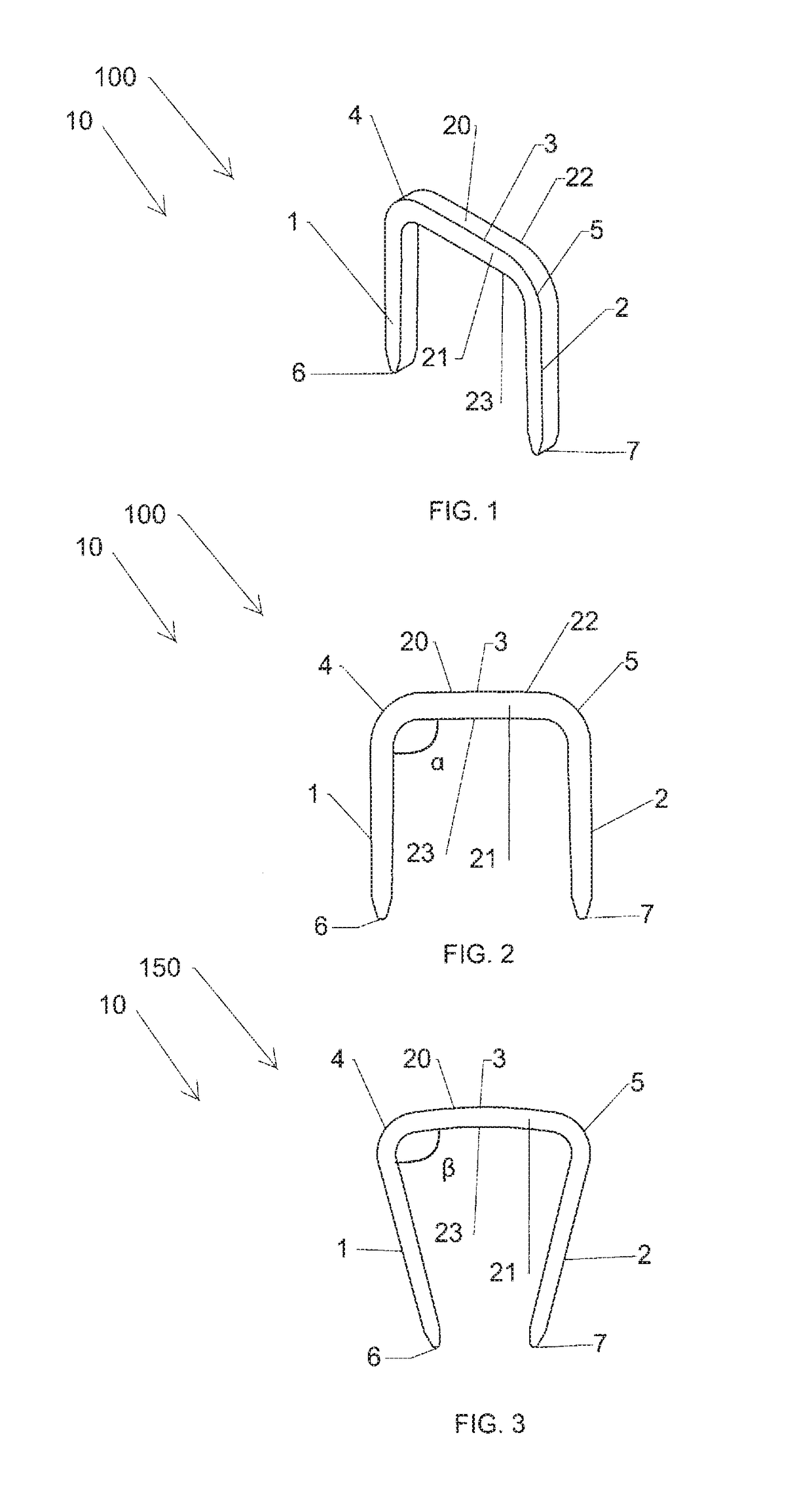 Elastic orthopedic implant and method of manufacturing thereof