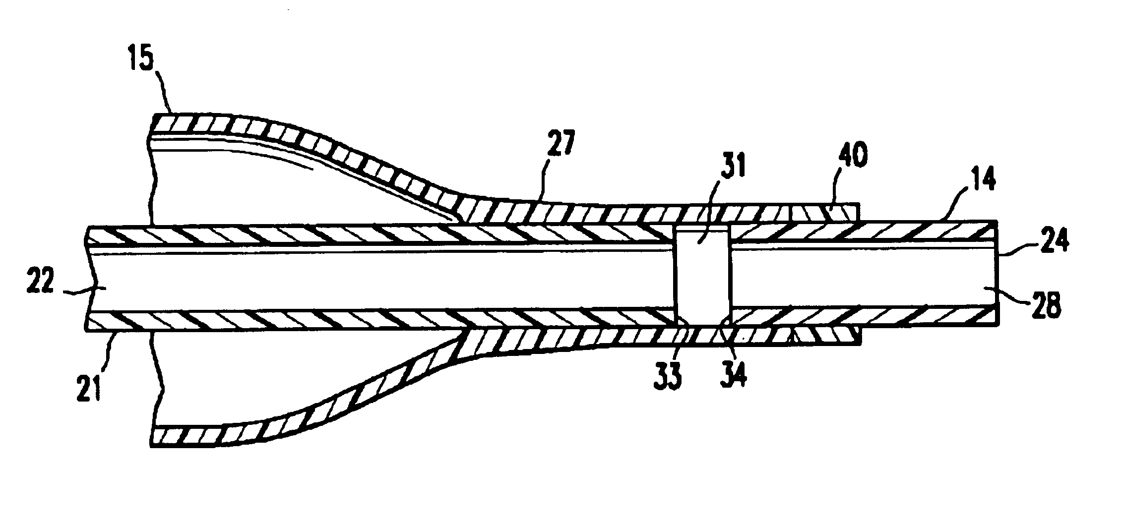 Catheter having a soft distal tip