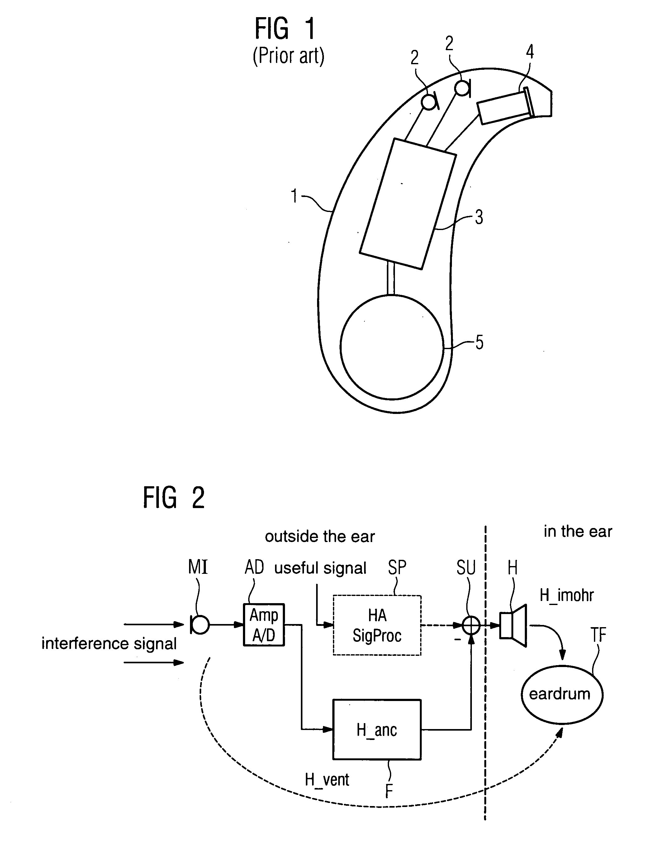 Hearing device with interference sound suppression and corresponding method
