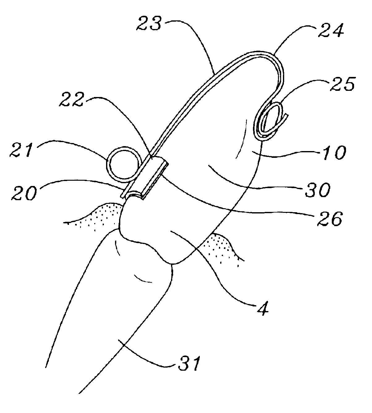 Attachment offset tooth eyelet