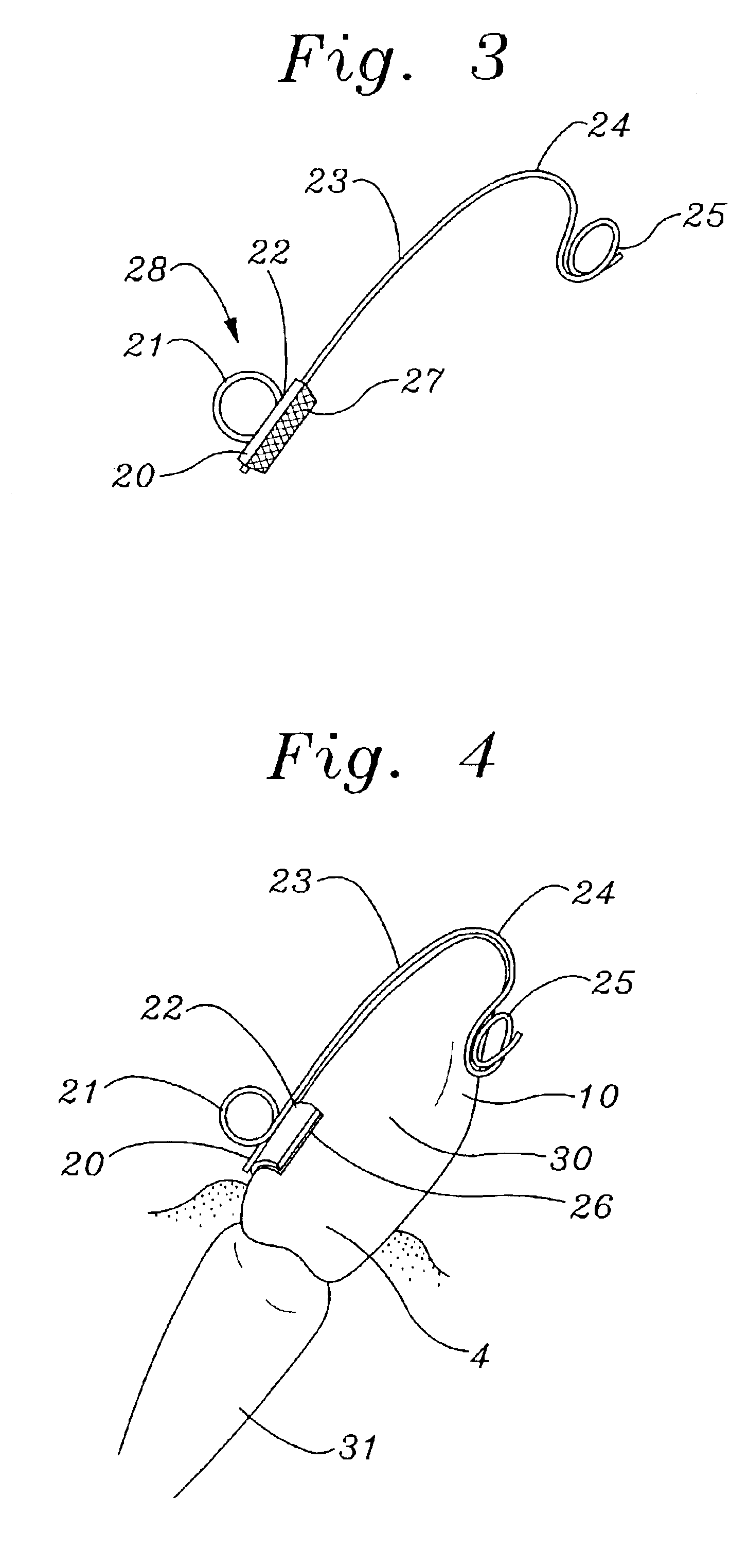 Attachment offset tooth eyelet