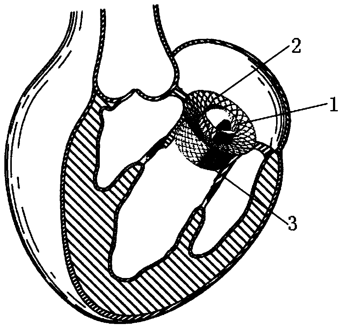 Artificial heart valve