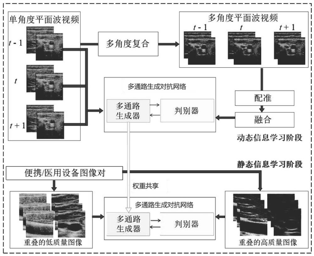 Portable ultrasonic video optimization reconstruction method of multi-channel generative adversarial network