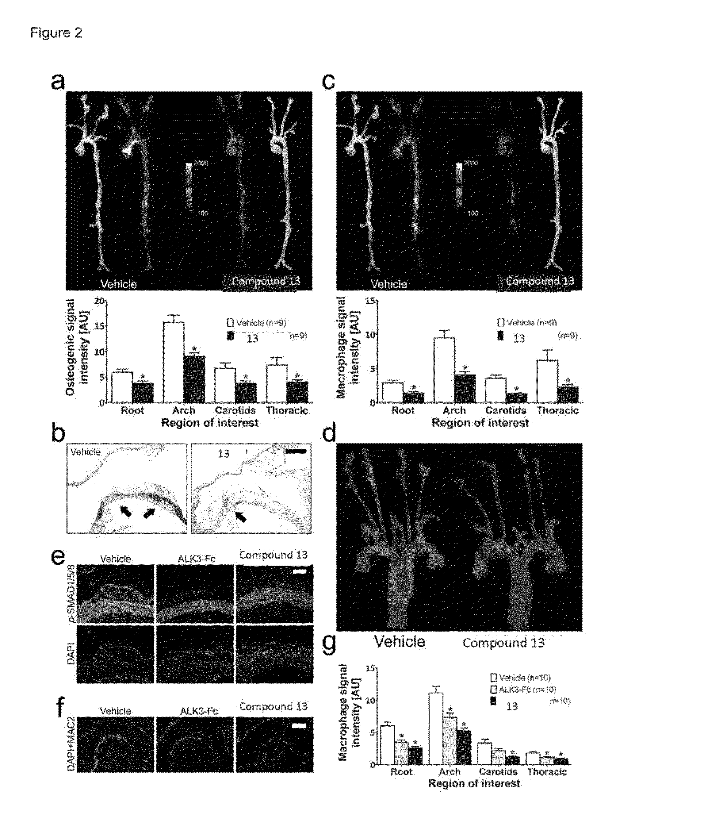 Compositions and methods for cardiovascular disease