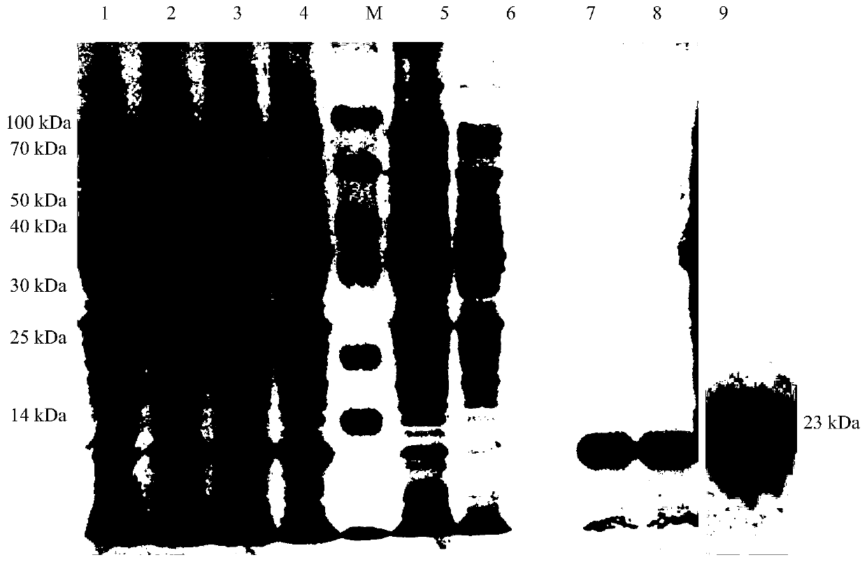 Preparation method and application of multi-epitope fusion diagnostic antigen protein of Echinococcus granulosus