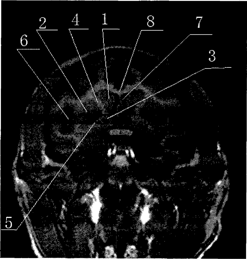 Cynomolgus monkey magnetic resonance scanning method