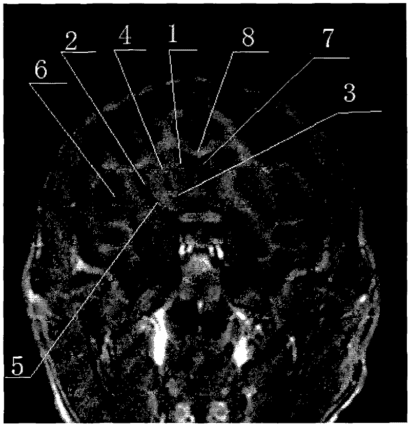 Cynomolgus monkey magnetic resonance scanning method