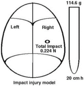 Application of butylphthalide and its derivatives in preparation of medicines for treating or preventing cerebral concussion