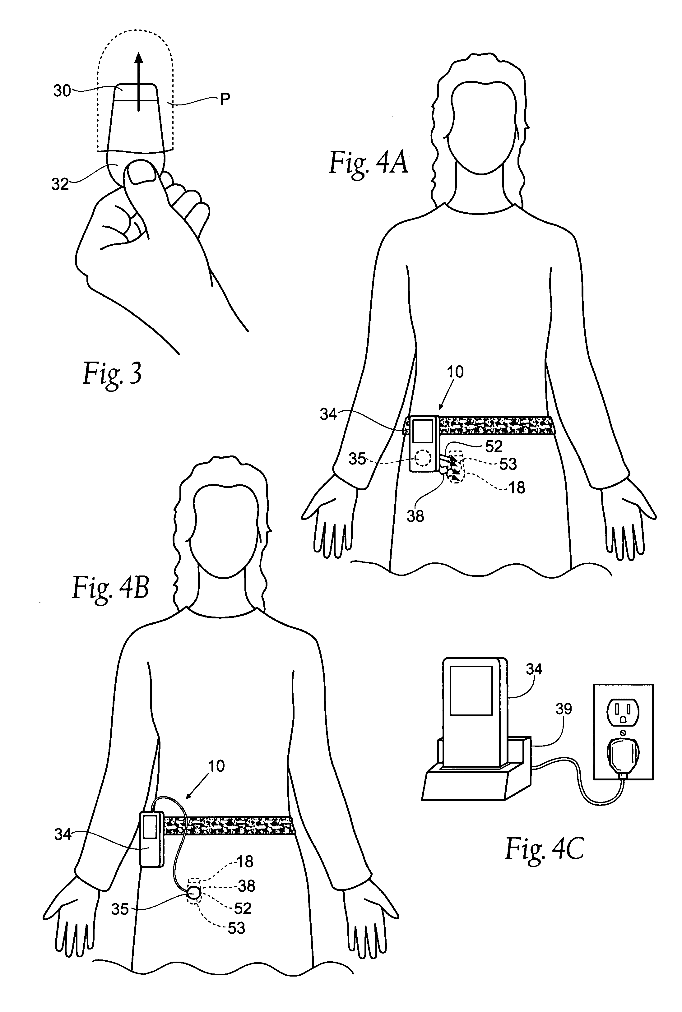 Implantable pulse generator for providing functional and/or therapeutic stimulation of muscles and/or nerves and/or central nervous system tissue