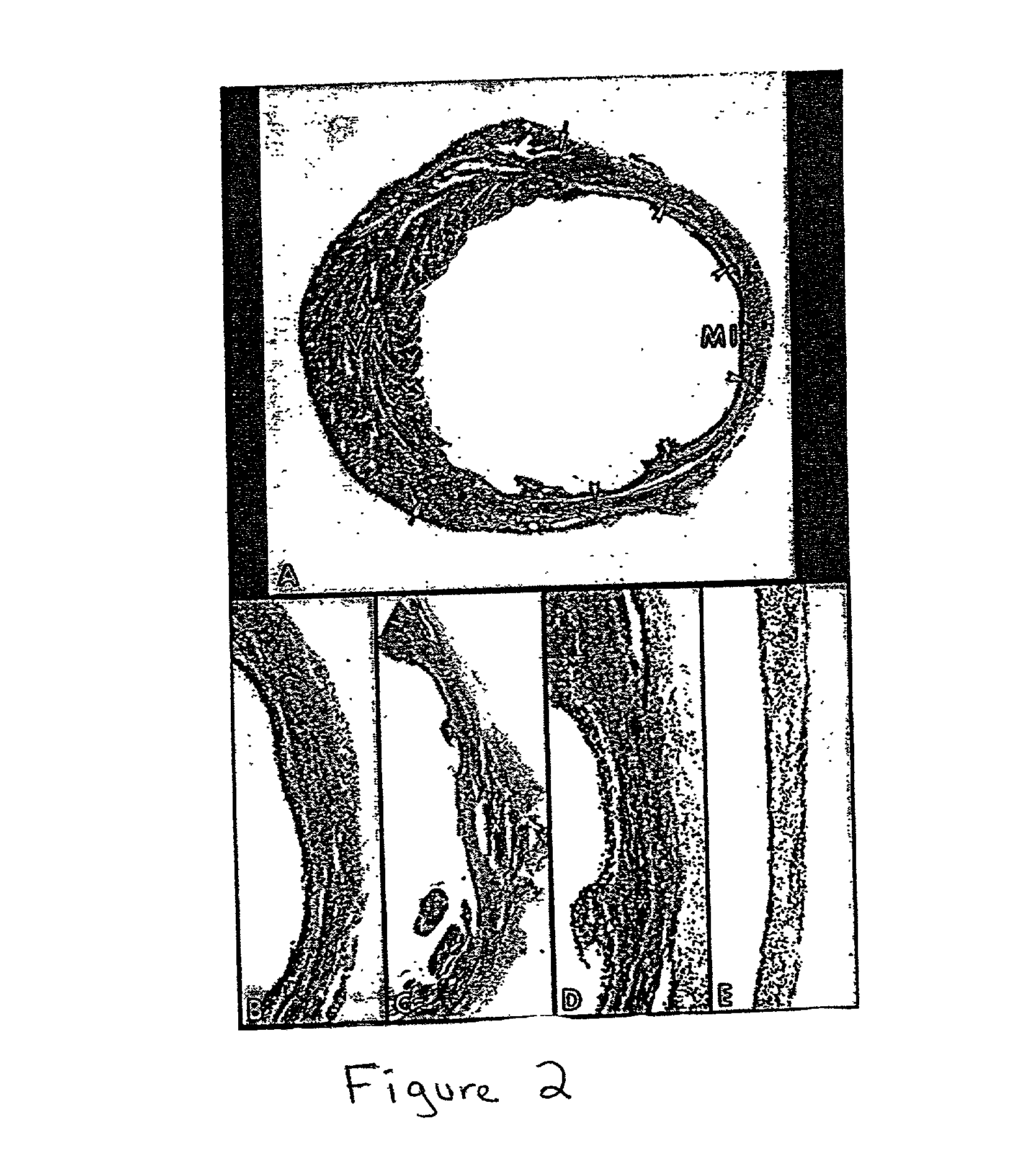 Methods and compositions for the repair and/or regeneration of damaged myocardium