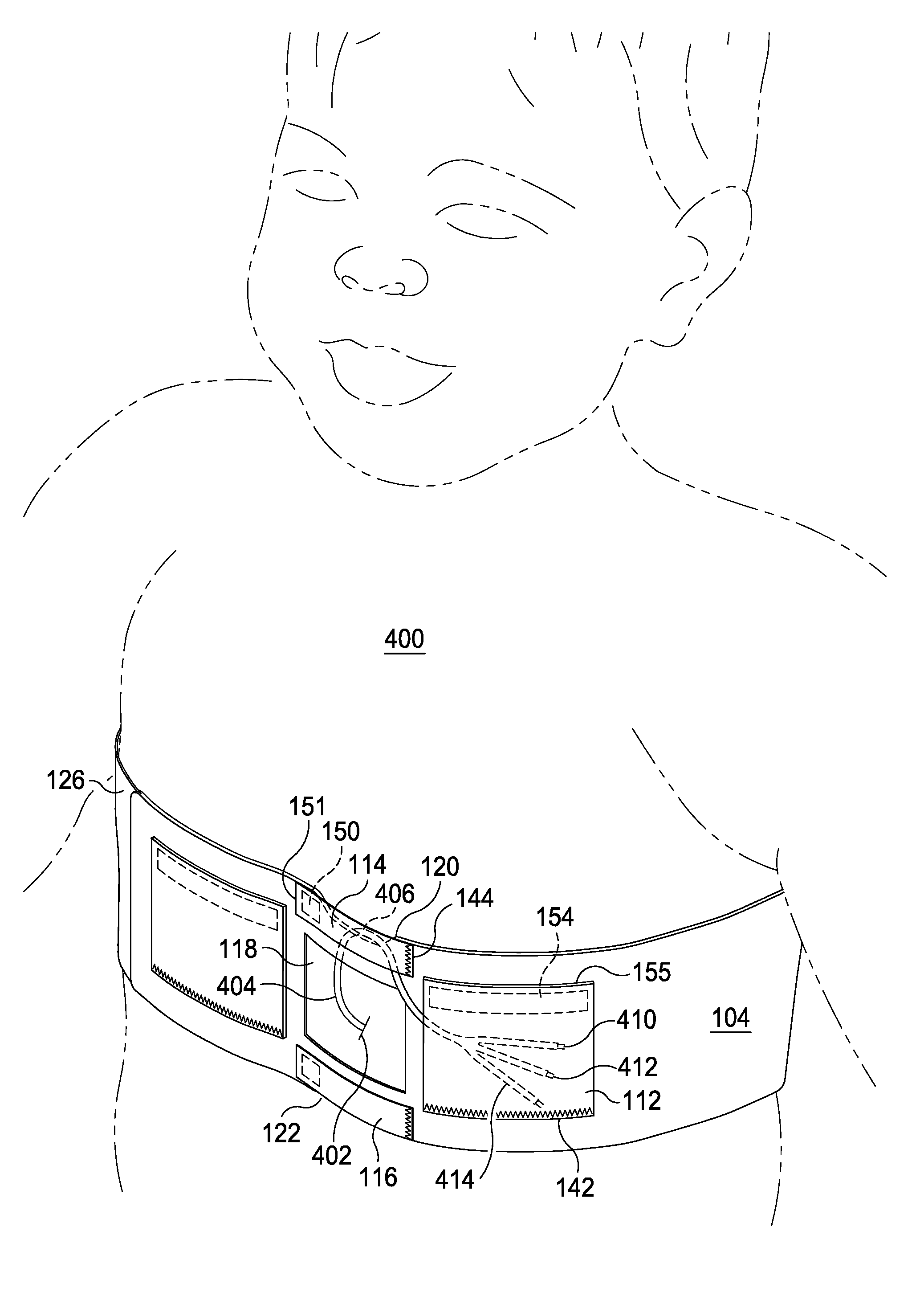 Apparatus and method for controlling visibility and access to central venous access devices