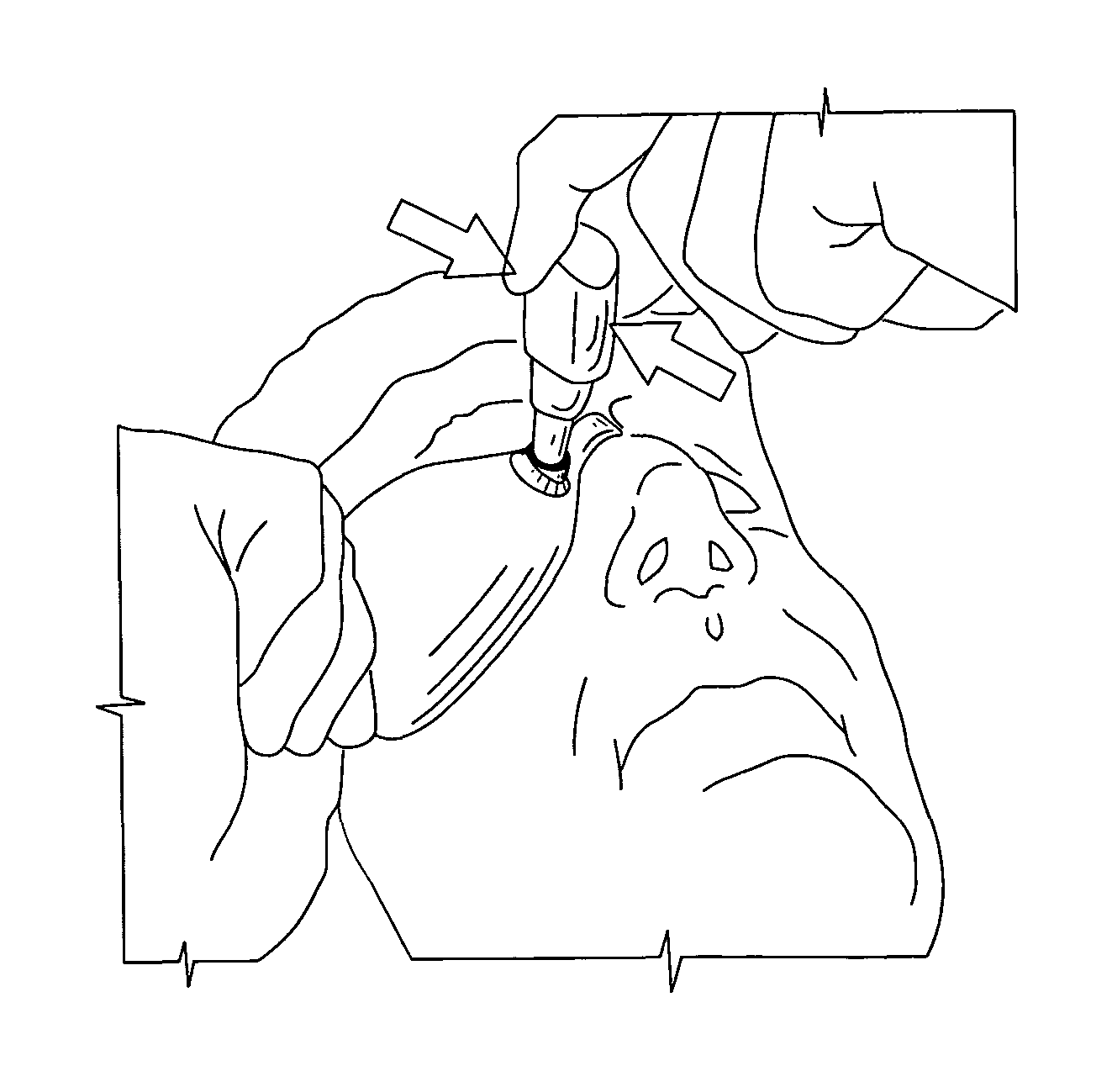 Device for administering eye drops