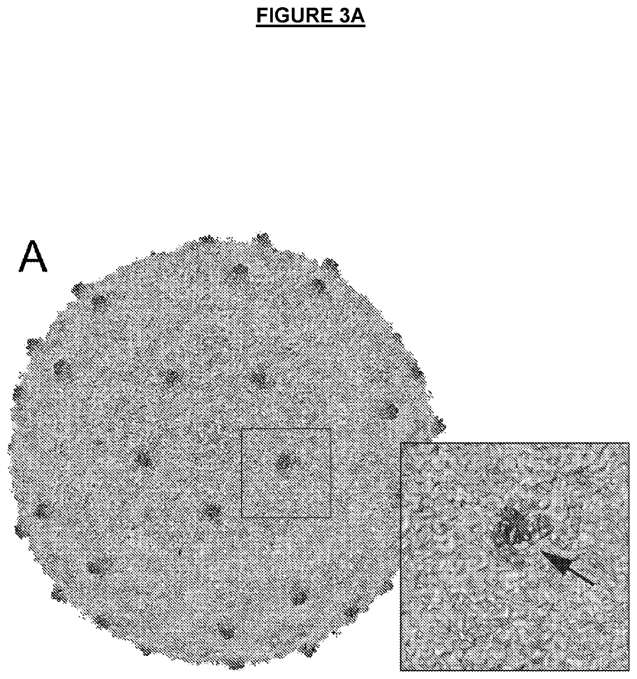 Polyomavirus neutralizing antibodies